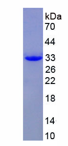 Recombinant Tyrosine Kinase, Non Receptor 2 (TNK2)