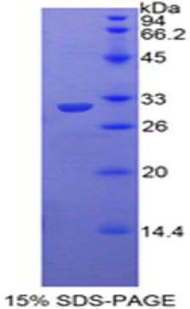 Recombinant Toll Interacting Protein (TOLLIP)