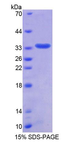 Recombinant Thymopoietin (TMPO)