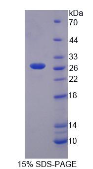 Recombinant Thyroid Stimulating Hormone Receptor (TSHR)