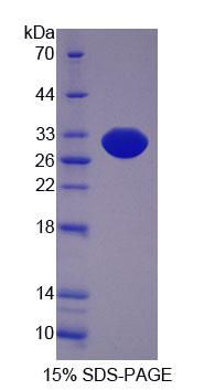 Recombinant Sciellin (SCEL)