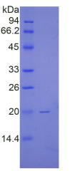 Recombinant Renalase (RNLS)