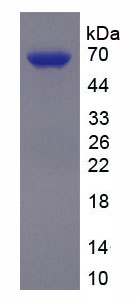 Recombinant Renalase (RNLS)