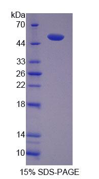 Recombinant Src Kinase Associated Phosphoprotein 1 (SKAP1)