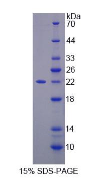 Recombinant Spermine Oxidase (SMOX)