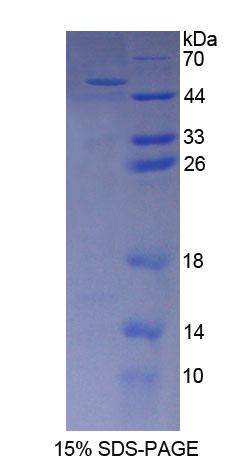 Recombinant Aminoadipate Semialdehyde Synthase (AASS)