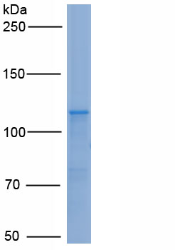 Recombinant Aminoadipate Semialdehyde Synthase (AASS)