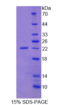 Recombinant Smoothelin (SMTN)