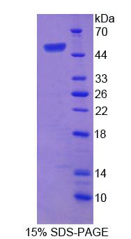 Recombinant Synuclein Alpha Interacting Protein 1 (SNCaIP1)