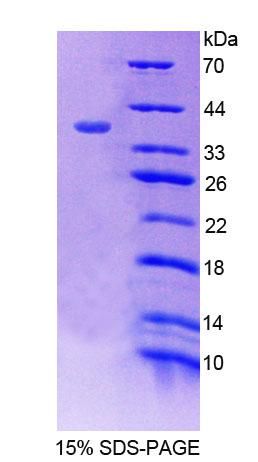 Recombinant Syntrophin Beta 1 (SNTb1)