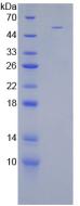 Recombinant Stanniocalcin 1 (STC1)