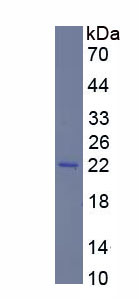 Recombinant Supervillin (SVIL)