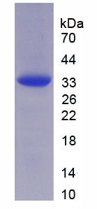 Recombinant Chromogranin B (CHGB)