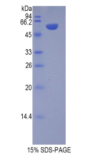 Recombinant Chromogranin B (CHGB)