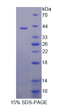 Recombinant Serotonin Transporter (SERT)