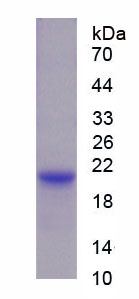 Recombinant Stathmin 1 (STMN1)