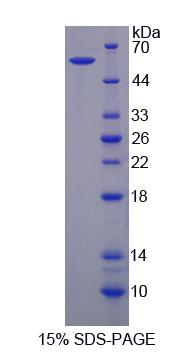 Recombinant Sortilin 1 (SORT1)