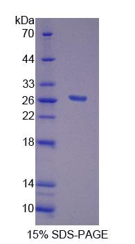 Recombinant Fibroblast Growth Factor 20 (FGF20)