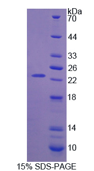 Recombinant Fibroblast Growth Factor 11 (FGF11)