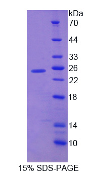 Recombinant Fibroblast Growth Factor 12 (FGF12)