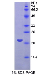 RPC915Hu02.jpg