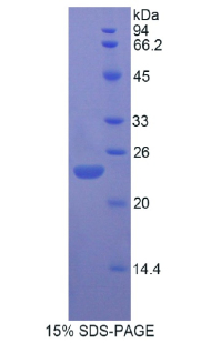 Recombinant Fibroblast Growth Factor 13 (FGF13)