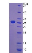 Recombinant Fibroblast Growth Factor 19 (FGF19)