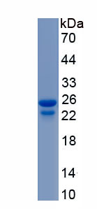 Recombinant Fibroblast Growth Factor 21 (FGF21)