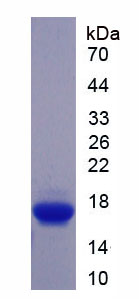 Recombinant Cannabinoid Receptor 1, Brain (CNR1)