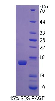 Recombinant Cannabinoid Receptor 1, Brain (CNR1)