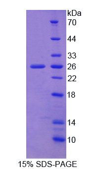 Recombinant Amyloid Beta Precursor Protein Binding Protein 2 (APPBP2)