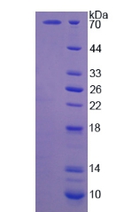 Recombinant Calpain 5 (CAPN5)