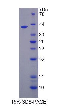 Recombinant Calpain 5 (CAPN5)