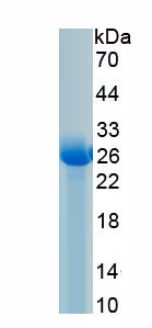 Recombinant Cathepsin B (CTSB)