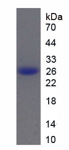 Recombinant Cathepsin B (CTSB)