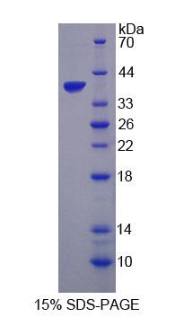 Recombinant Cathepsin H (CTSH)