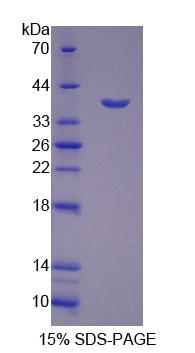 Recombinant Cathepsin H (CTSH)