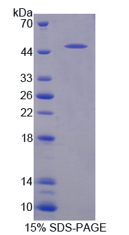 Recombinant Transforming Growth Factor Beta Receptor II (TGFbR2)