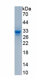 Recombinant Complement Component 6 (C6)