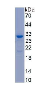 Recombinant Carcinoembryonic Antigen Related Cell Adhesion Molecule 1 (CEACAM1)