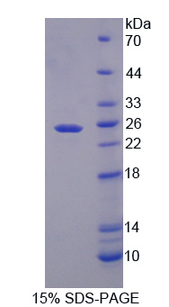 Recombinant Crystallin Gamma F (CRYgF)