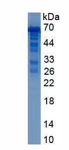 Recombinant Asparaginyl tRNA Synthetase (NARS)