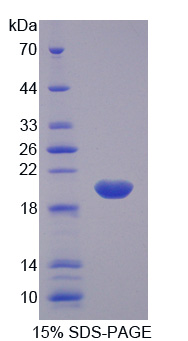 Recombinant Arginyl tRNA Synthetase (RARS)