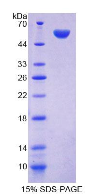 Recombinant Phenylalanyl tRNA Synthetase 2, Mitochondrial (FARS2)