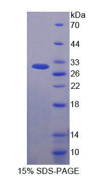 Recombinant Lysyl tRNA Synthetase (KARS)