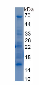 Recombinant Isoleucyl tRNA Synthetase (IARS)