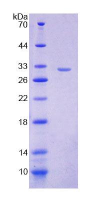 Recombinant Valyl tRNA Synthetase (VARS)