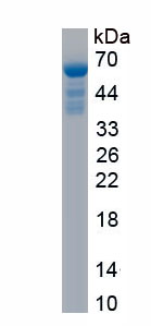 Recombinant Glutamyl Prolyl tRNA Synthetase (EPRS)