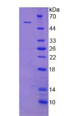 Recombinant X-Ray Repair Cross Complementing 5 (XRCC5)