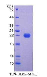 Recombinant Ferritin, Light Polypeptide (FTL)